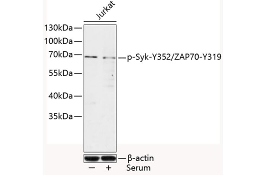 Western Blot - Anti-Syk (phospho Tyr352) + ZAP70 (phospho Tyr319) Antibody (A10981) - Antibodies.com