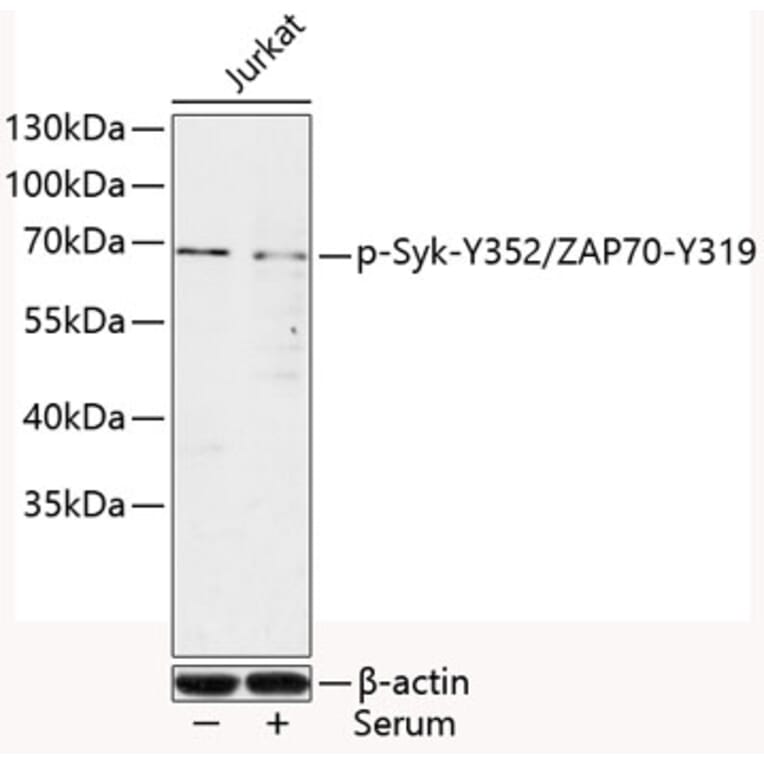 Western Blot - Anti-Syk (phospho Tyr352) + ZAP70 (phospho Tyr319) Antibody (A10981) - Antibodies.com