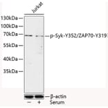 Western Blot - Anti-Syk (phospho Tyr352) + ZAP70 (phospho Tyr319) Antibody (A10981) - Antibodies.com