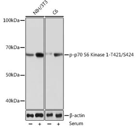 Western Blot - Anti-S6K1 (phospho Thr421 + Ser424) Antibody [ARC0107] (A10982) - Antibodies.com