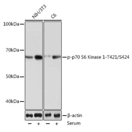 Western Blot - Anti-S6K1 (phospho Thr421 + Ser424) Antibody [ARC0107] (A10982) - Antibodies.com
