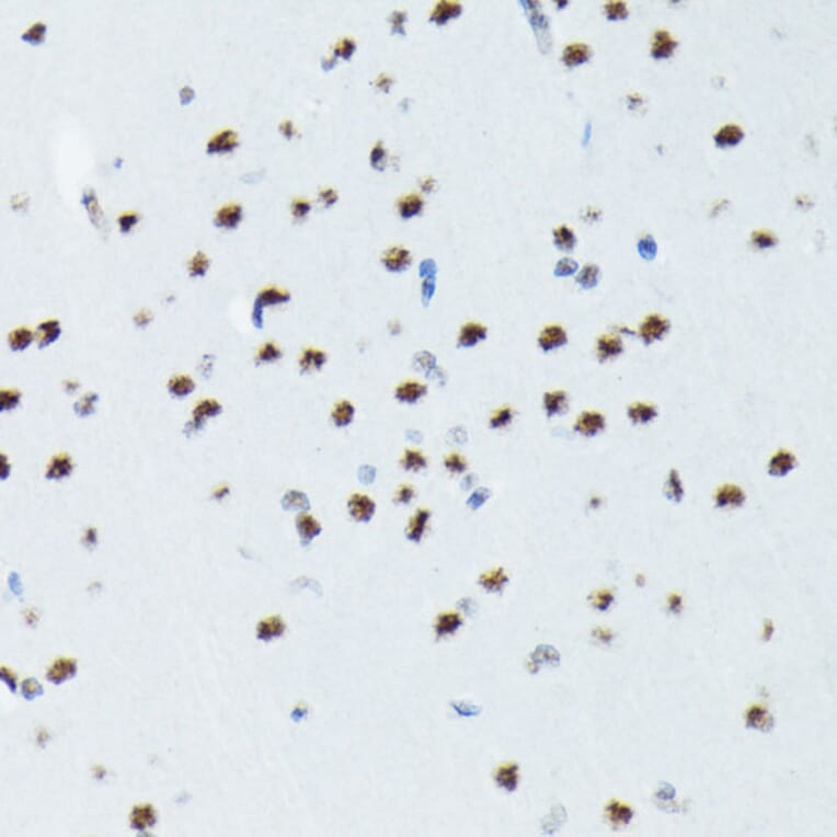 Immunohistochemistry - Anti-S6K1 (phospho Thr421 + Ser424) Antibody [ARC0107] (A10982) - Antibodies.com