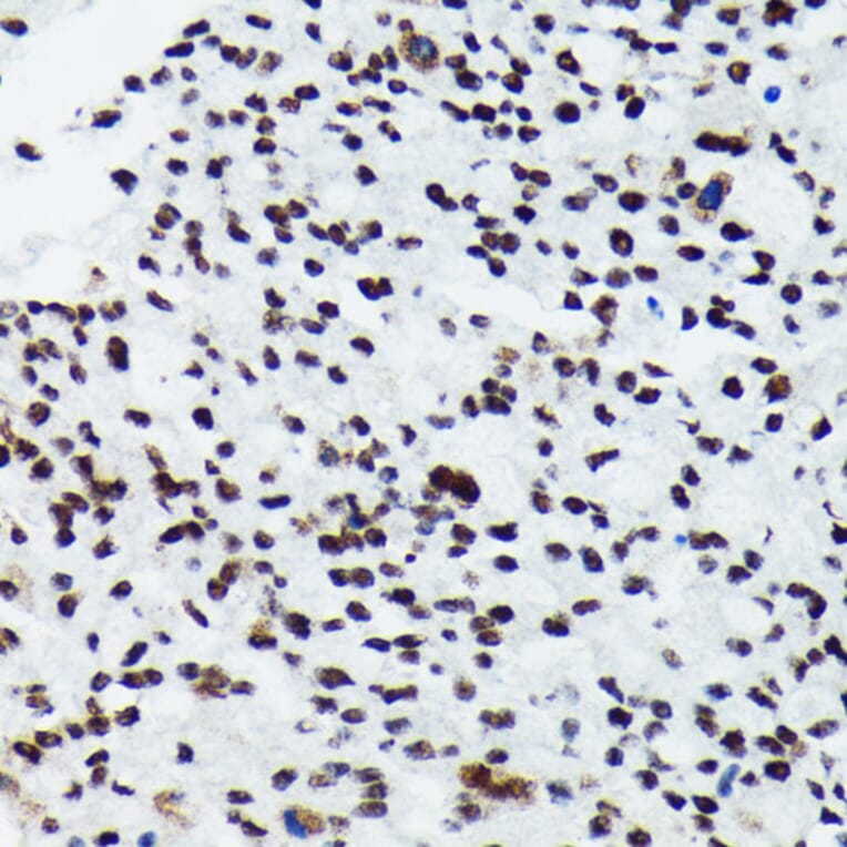 Immunohistochemistry - Anti-S6K1 (phospho Thr421 + Ser424) Antibody [ARC0107] (A10982) - Antibodies.com