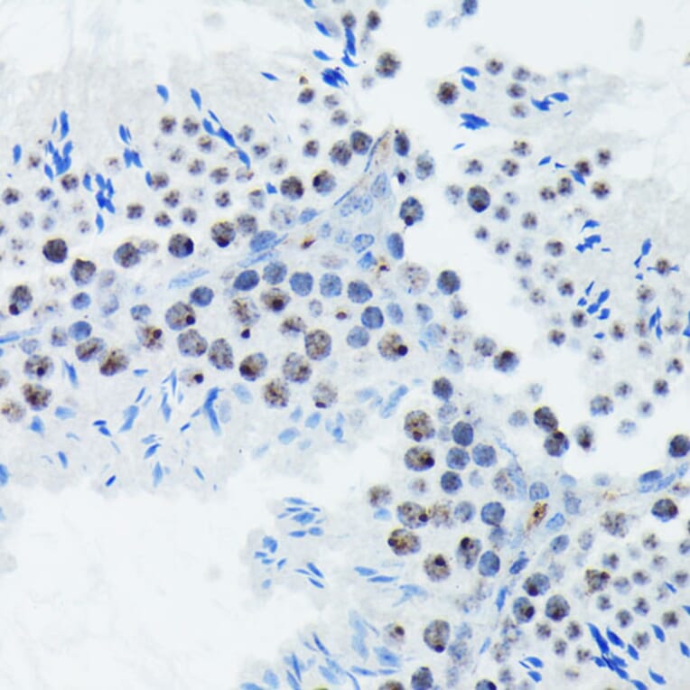 Immunohistochemistry - Anti-S6K1 (phospho Thr421 + Ser424) Antibody [ARC0107] (A10982) - Antibodies.com