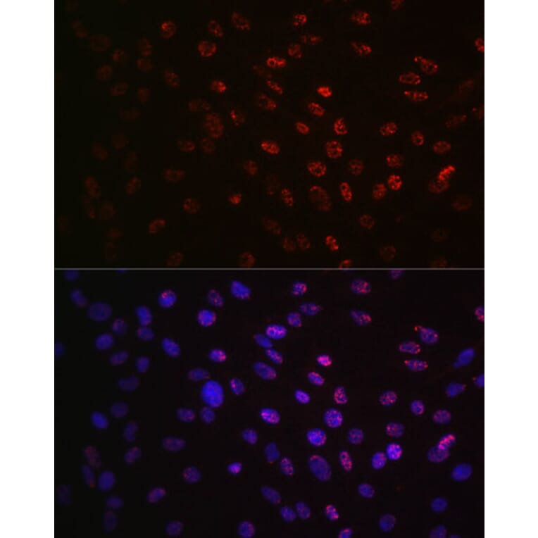 Immunofluorescence - Anti-S6K1 (phospho Thr421 + Ser424) Antibody [ARC0107] (A10982) - Antibodies.com