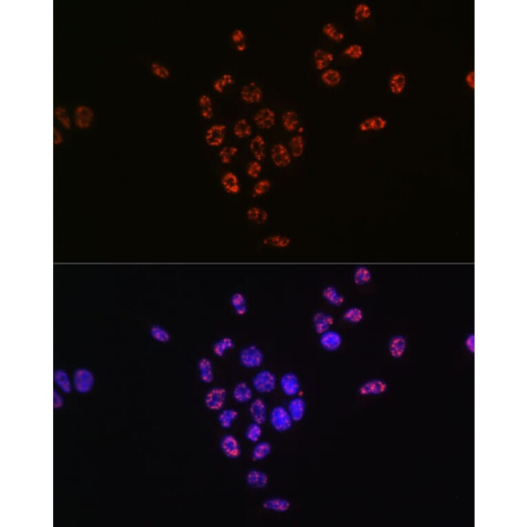 Immunofluorescence - Anti-S6K1 (phospho Thr421 + Ser424) Antibody [ARC0107] (A10982) - Antibodies.com