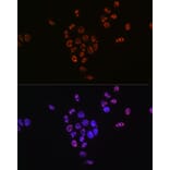 Immunofluorescence - Anti-S6K1 (phospho Thr421 + Ser424) Antibody [ARC0107] (A10982) - Antibodies.com