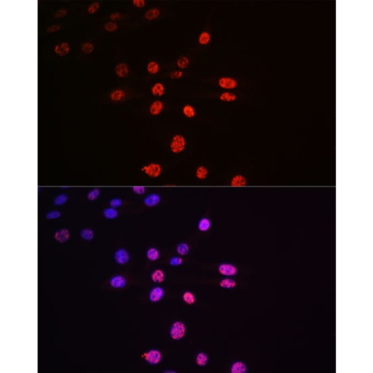 Immunofluorescence - Anti-S6K1 (phospho Thr421 + Ser424) Antibody [ARC0107] (A10982) - Antibodies.com