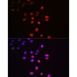Immunofluorescence - Anti-S6K1 (phospho Thr421 + Ser424) Antibody [ARC0107] (A10982) - Antibodies.com
