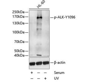 Western Blot - Anti-ALK (phospho Tyr1096) Antibody (A10983) - Antibodies.com