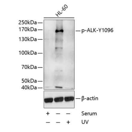 Western Blot - Anti-ALK (phospho Tyr1096) Antibody (A10983) - Antibodies.com