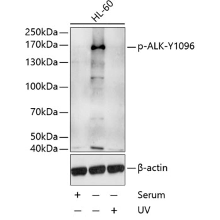 Western Blot - Anti-ALK (phospho Tyr1096) Antibody (A10983) - Antibodies.com