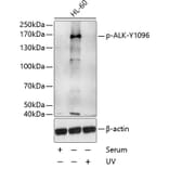 Western Blot - Anti-ALK (phospho Tyr1096) Antibody (A10983) - Antibodies.com