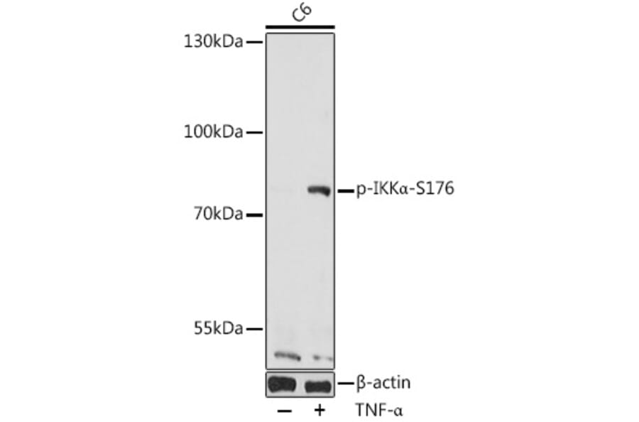 Western Blot - Anti-IKK alpha (phospho Ser176) Antibody (A10985) - Antibodies.com