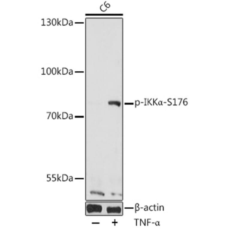 Western Blot - Anti-IKK alpha (phospho Ser176) Antibody (A10985) - Antibodies.com