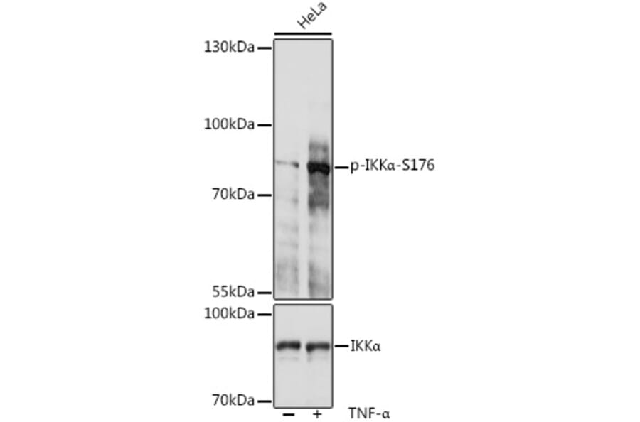 Western Blot - Anti-IKK alpha (phospho Ser176) Antibody (A10985) - Antibodies.com
