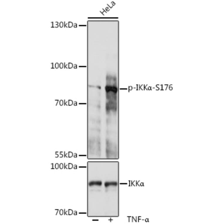 Western Blot - Anti-IKK alpha (phospho Ser176) Antibody (A10985) - Antibodies.com