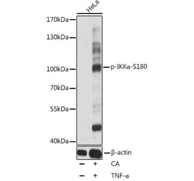 Western Blot - Anti-IKK alpha (phospho Ser180) Antibody (A10986) - Antibodies.com