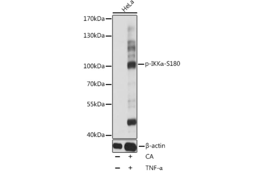 Western Blot - Anti-IKK alpha (phospho Ser180) Antibody (A10986) - Antibodies.com