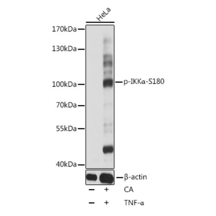 Western Blot - Anti-IKK alpha (phospho Ser180) Antibody (A10986) - Antibodies.com