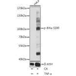 Western Blot - Anti-IKK alpha (phospho Ser180) Antibody (A10986) - Antibodies.com