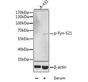 Western Blot - Anti-Fyn (phospho Ser21) Antibody (A10990) - Antibodies.com