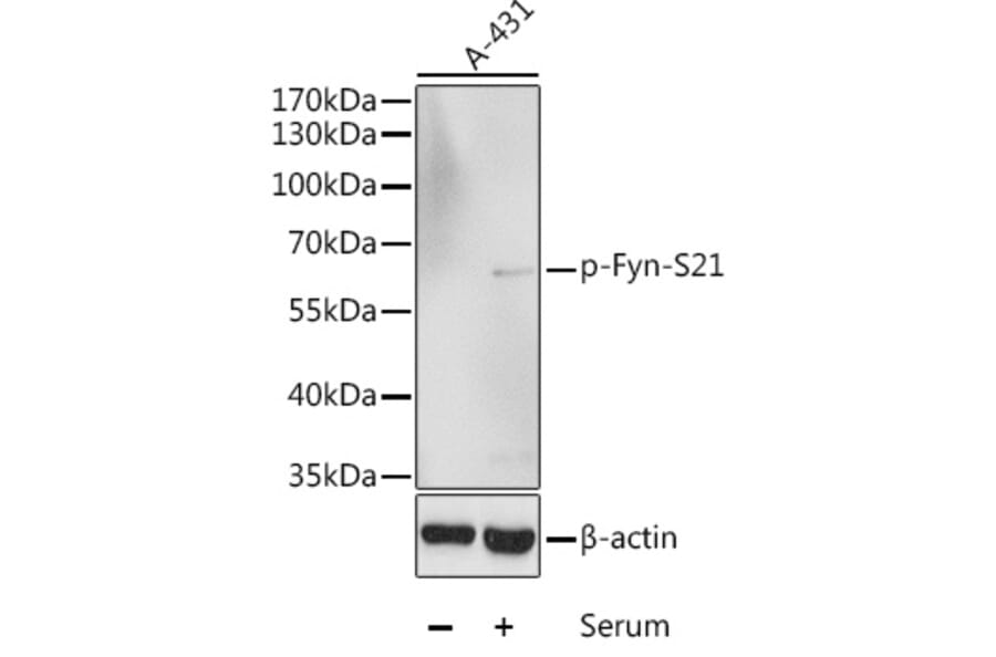 Western Blot - Anti-Fyn (phospho Ser21) Antibody (A10990) - Antibodies.com