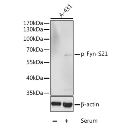 Western Blot - Anti-Fyn (phospho Ser21) Antibody (A10990) - Antibodies.com