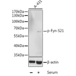 Western Blot - Anti-Fyn (phospho Ser21) Antibody (A10990) - Antibodies.com