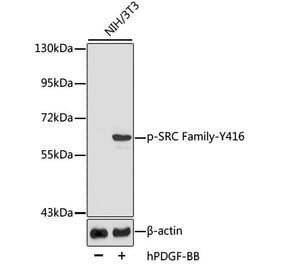 Western Blot - Anti-SRC family (phospho Tyr416) Antibody (A10991) - Antibodies.com