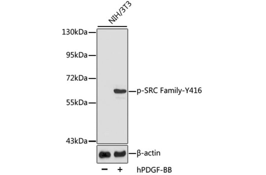 Western Blot - Anti-SRC family (phospho Tyr416) Antibody (A10991) - Antibodies.com