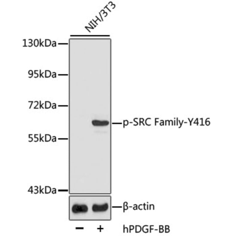 Western Blot - Anti-SRC family (phospho Tyr416) Antibody (A10991) - Antibodies.com