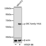 Western Blot - Anti-SRC family (phospho Tyr416) Antibody (A10991) - Antibodies.com