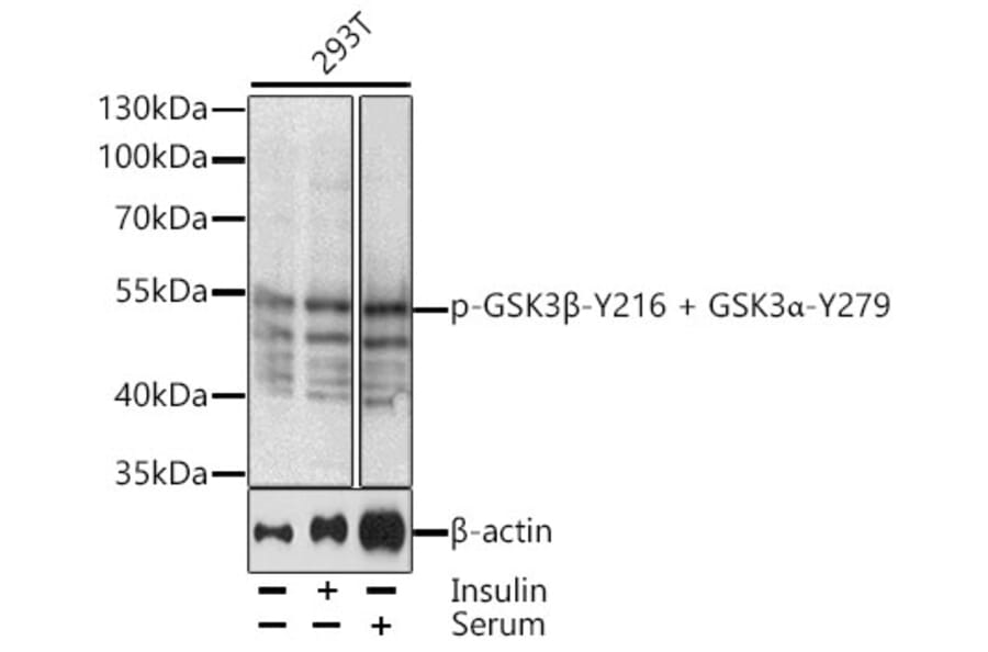 Western Blot - Anti-GSK3 alpha (phospho Tyr279) + GSK3 beta (phospho Tyr216) Antibody (A10992) - Antibodies.com