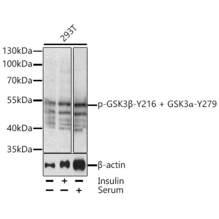 Western Blot - Anti-GSK3 alpha (phospho Tyr279) + GSK3 beta (phospho Tyr216) Antibody (A10992) - Antibodies.com