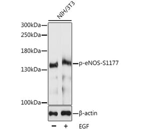 Western Blot - Anti-eNOS (phospho Ser1177) Antibody (A10995) - Antibodies.com