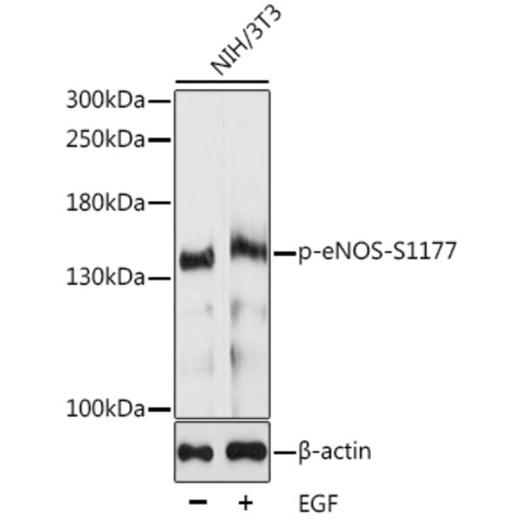 Western Blot - Anti-eNOS (phospho Ser1177) Antibody (A10995) - Antibodies.com