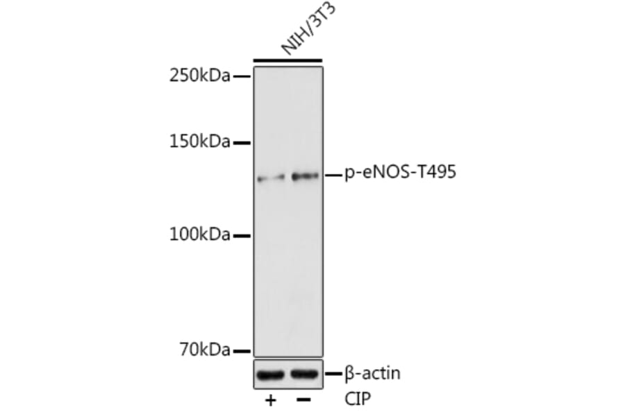 Western Blot - Anti-eNOS (phospho Thr495) Antibody (A10996) - Antibodies.com