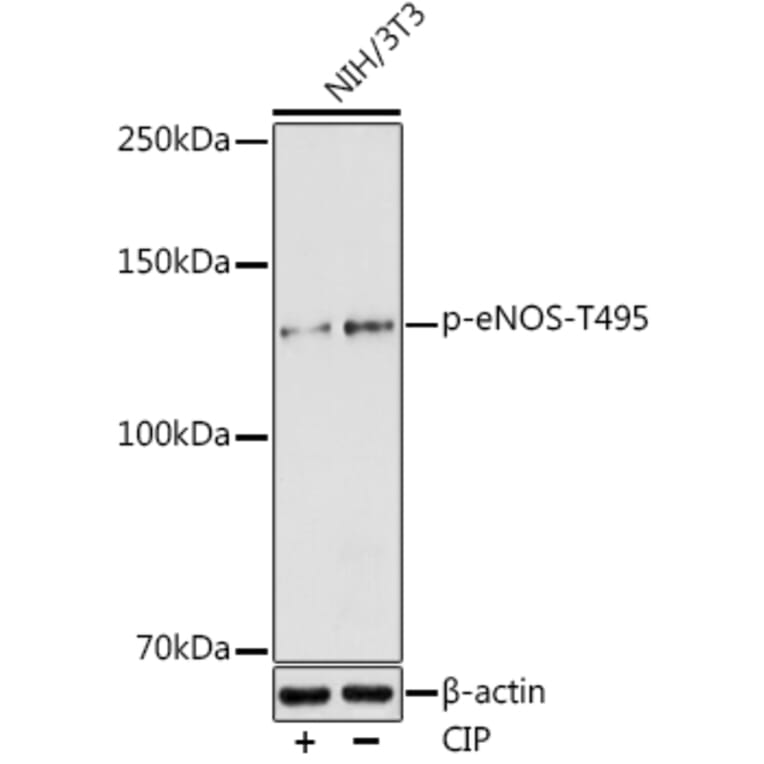 Western Blot - Anti-eNOS (phospho Thr495) Antibody (A10996) - Antibodies.com