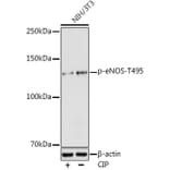 Western Blot - Anti-eNOS (phospho Thr495) Antibody (A10996) - Antibodies.com