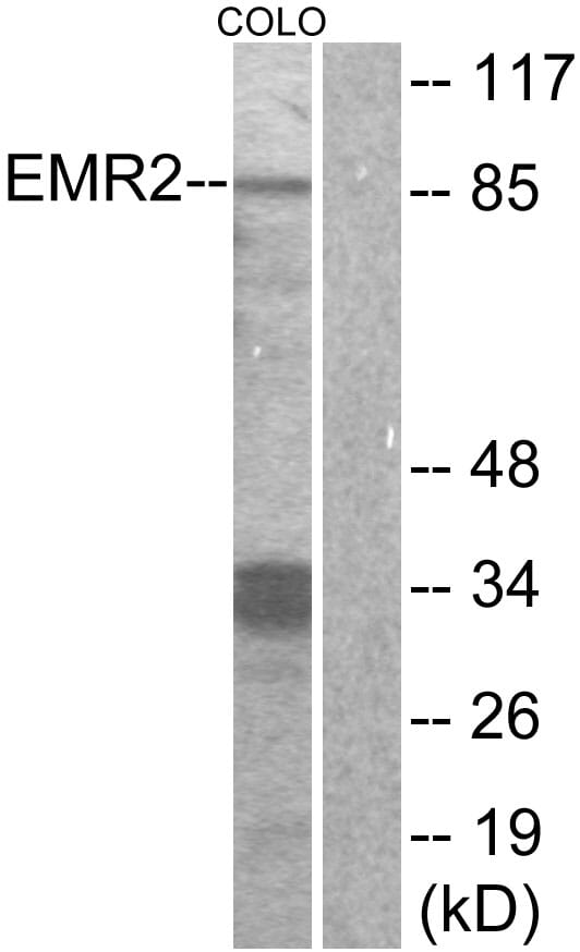 Western blot analysis of lysates from COLO cells using Anti-EMR2 Antibody. The right hand lane represents a negative control, where the antibody is blocked by the immunising peptide.