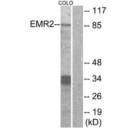 Western Blot - Anti-EMR2 Antibody (G091) - Antibodies.com