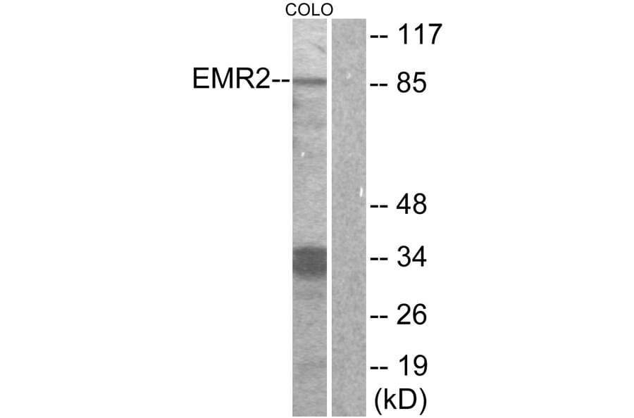 Western Blot - Anti-EMR2 Antibody (G091) - Antibodies.com