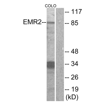 Western Blot - Anti-EMR2 Antibody (G091) - Antibodies.com