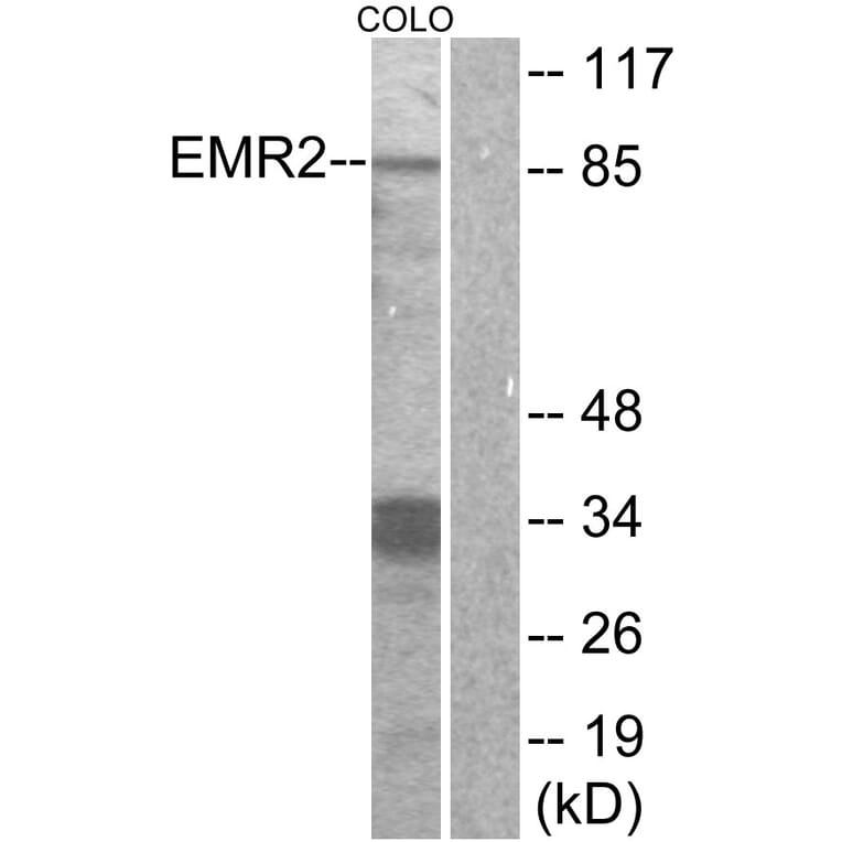 Western Blot - Anti-EMR2 Antibody (G091) - Antibodies.com