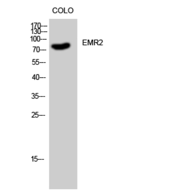 Western Blot - Anti-EMR2 Antibody (G091) - Antibodies.com