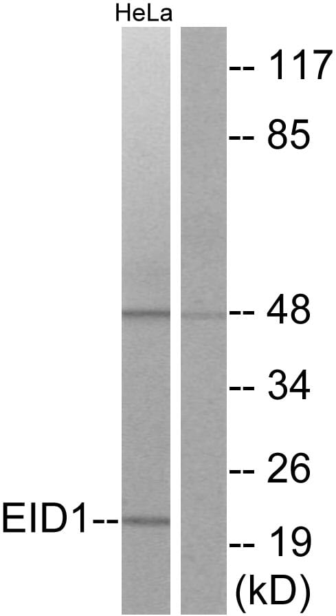 Western blot analysis of lysates from HeLa cells using Anti-EID1 Antibody. The right hand lane represents a negative control, where the antibody is blocked by the immunising peptide.