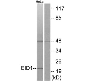 Western Blot - Anti-EID1 Antibody (C11984) - Antibodies.com