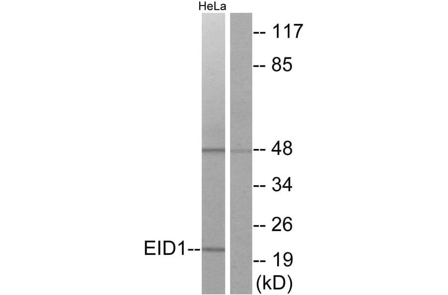 Western Blot - Anti-EID1 Antibody (C11984) - Antibodies.com