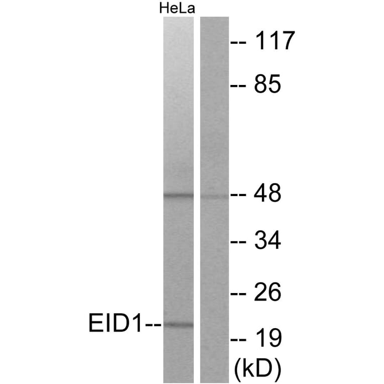 Western Blot - Anti-EID1 Antibody (C11984) - Antibodies.com